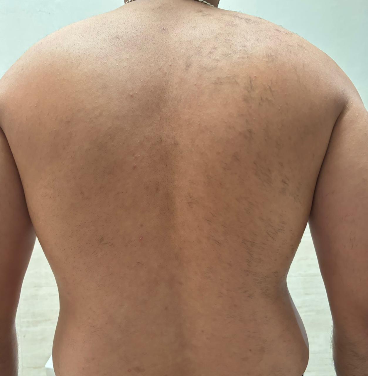 After treatment result