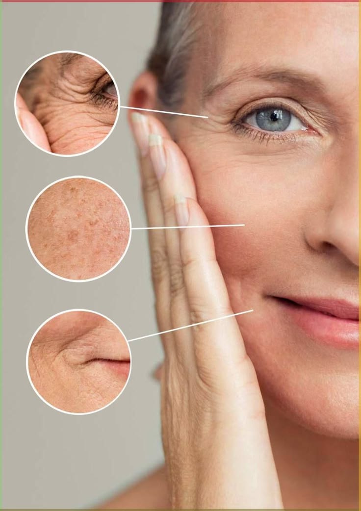 Anti-ageing treatment