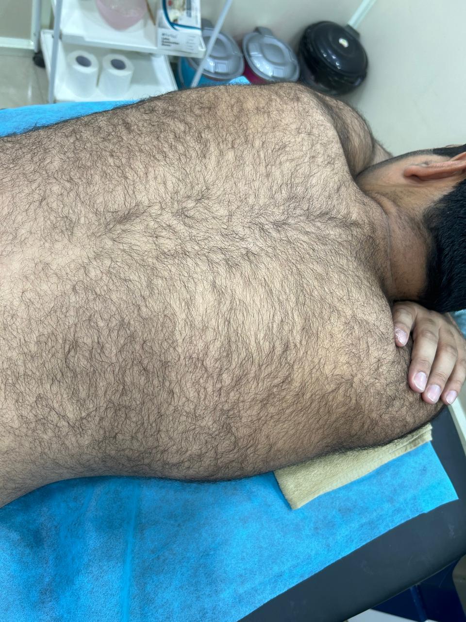 Before treatment result